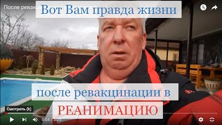 После ревакцинации в реанимацию.