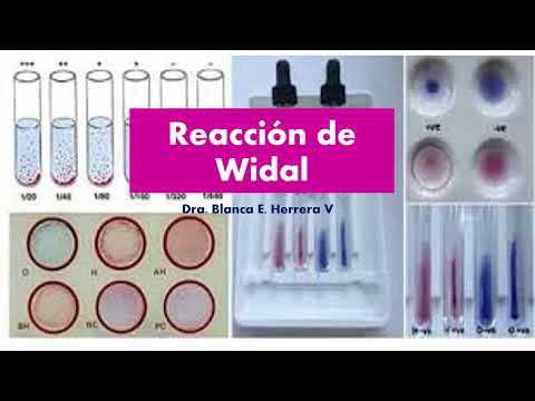 Video: ¿Cómo interpretar la prueba de widal?