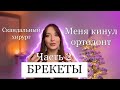 БРЕКЕТЫ Часть 2: МЕНЯ КИНУЛ ОРТОДОНТ. ОПЕРАЦИЯ. ВЫБРАЛА СКАНДАЛЬНОГО ХИРУРГА. СТОИМОСТЬ ОПЕРАЦИИ 😱