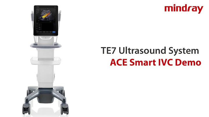 Mindray Smart IVC Demo Video | TE7 ACE, POC Ultrasound System