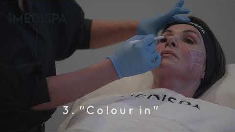 MD CODES: Foundational / Lifting codes CK1 & CK4