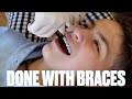 GETTING BRACES TAKEN OFF | BRACES REMOVED FOREVER | DONE WITH BRACES | BEFORE AND AFTER BRACES