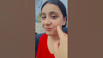 خدود هيلين 