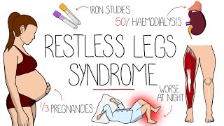 Restless Legs Syndrome Explained (Willis-Ekbom Disease)