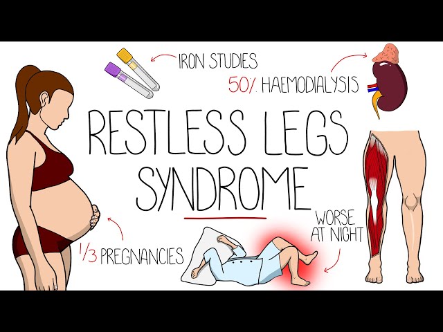 Restless Legs Syndrome Explained (Willis-Ekbom Disease)
