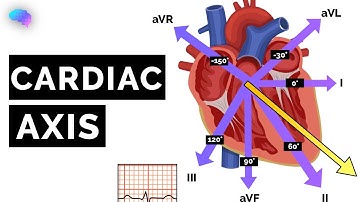 Cardiac Axis Explained | ECG | EKG | OSCE Guide | UKMLA | CPSA | PLAB 2