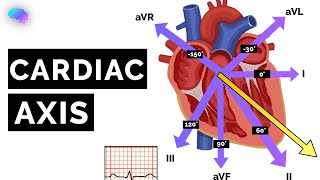 Cardiac Axis Explained | ECG | EKG | OSCE Guide | UKMLA | CPSA