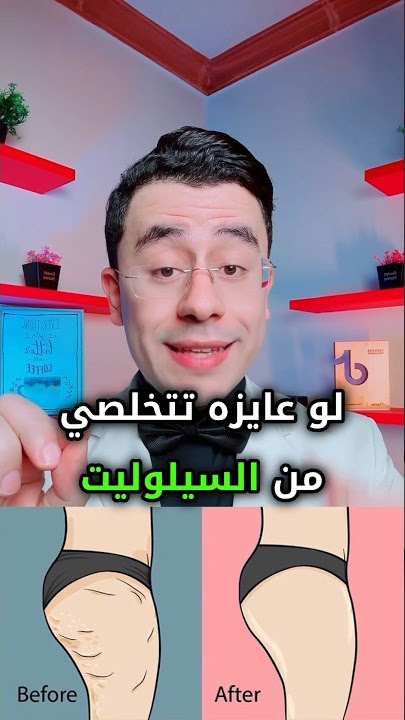 الحل النهائي للسيلوليت