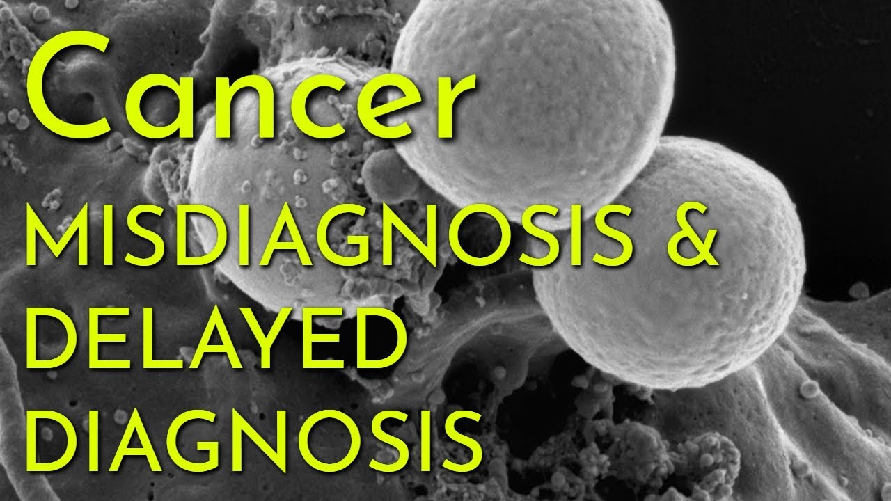 877-ASK4SAM Long Island NY Cancer Misdiagnosis Lawsuit & Delayed Diagnosis Attorney