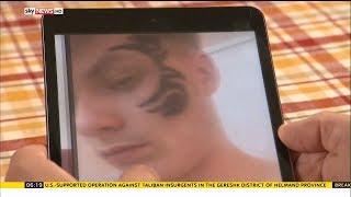 Pain and scarring: Black henna tattoo warning - Rebecca Williams
