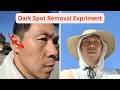 I'm using Sunshine to Heal My Dark Spots (Day 1) #darkspots  #darkspotremedy
