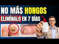 ¡Elimina el hongo de las uñas de pies y manos en 7 días! El REMEDIO CASERO más PODEROSO