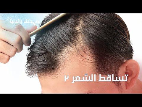 فيديو: 3 طرق لقياس تساقط الشعر