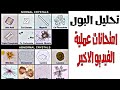 فحص البول الكامل  الجزء العملي + امتحانات عمليه