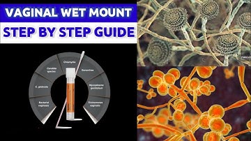Vaginal Wet Mount Preparation| |MEDICAL LABORATORY SCIENCE