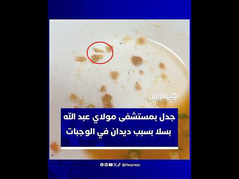 جدل في مستشفى مولاي عبد الله بسبب فيديو يظهر ديدانا في وجبات المرضى