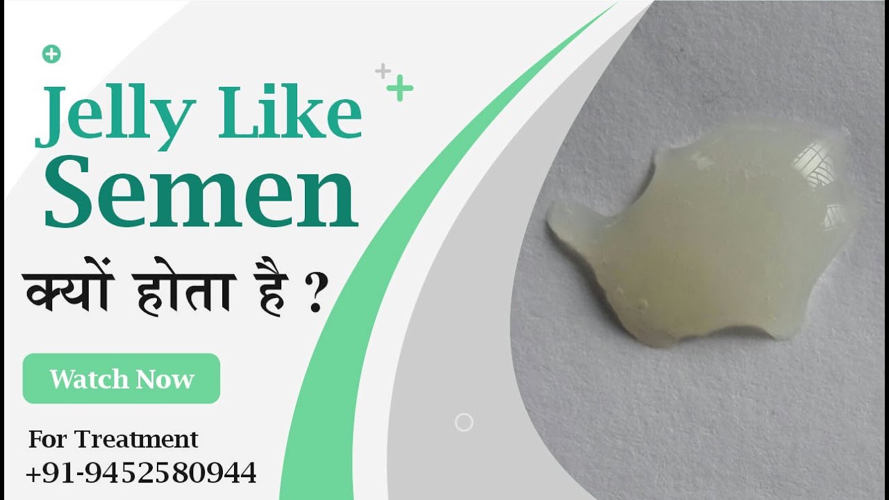 What Does Thick Jelly Sperm Mean Or Is Clumpy Sperm Healthy By Dr Nizamuddin Qasmi Youtube 