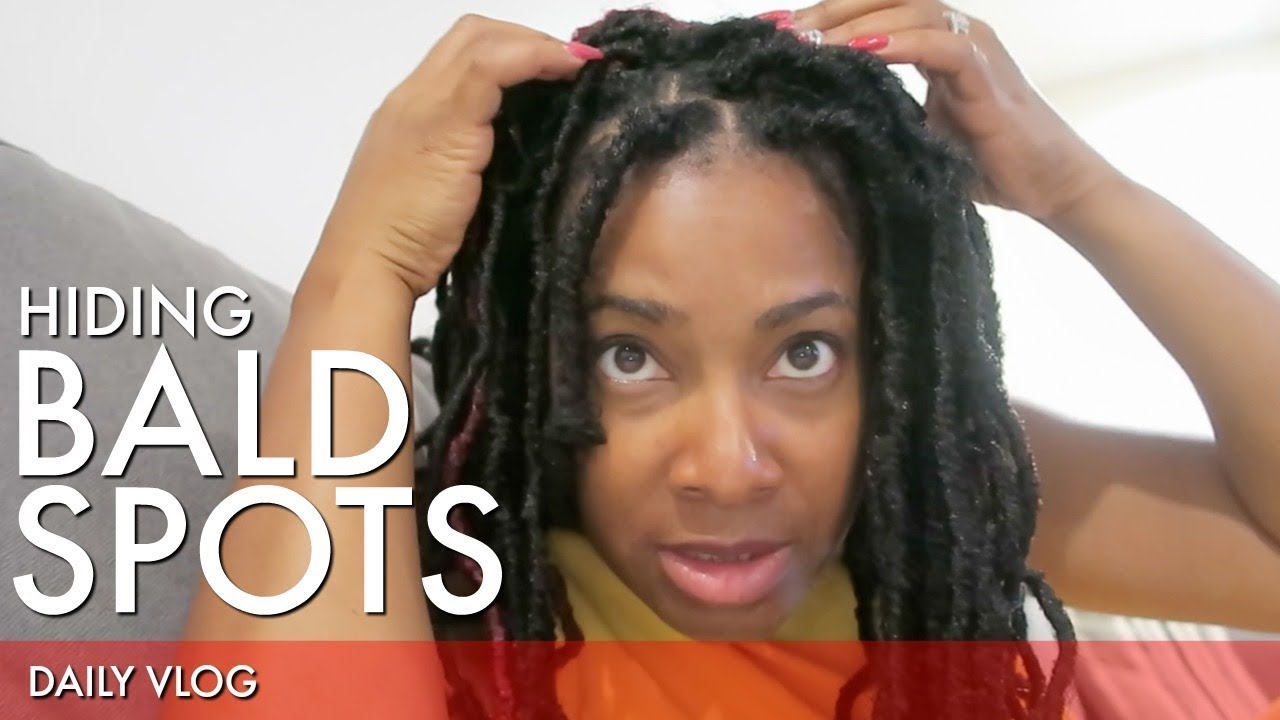 Covering Up Hair Loss That Chick Angel TV YouTube