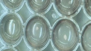 Scientists use stem cells to grow human livers in mice