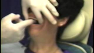 Basic Articulator System Instruction Part 2