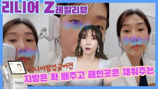 [리니어Z레알리뷰] 지방은 확 빼주고 패인곳은 채워주는 강력한 리니어Z