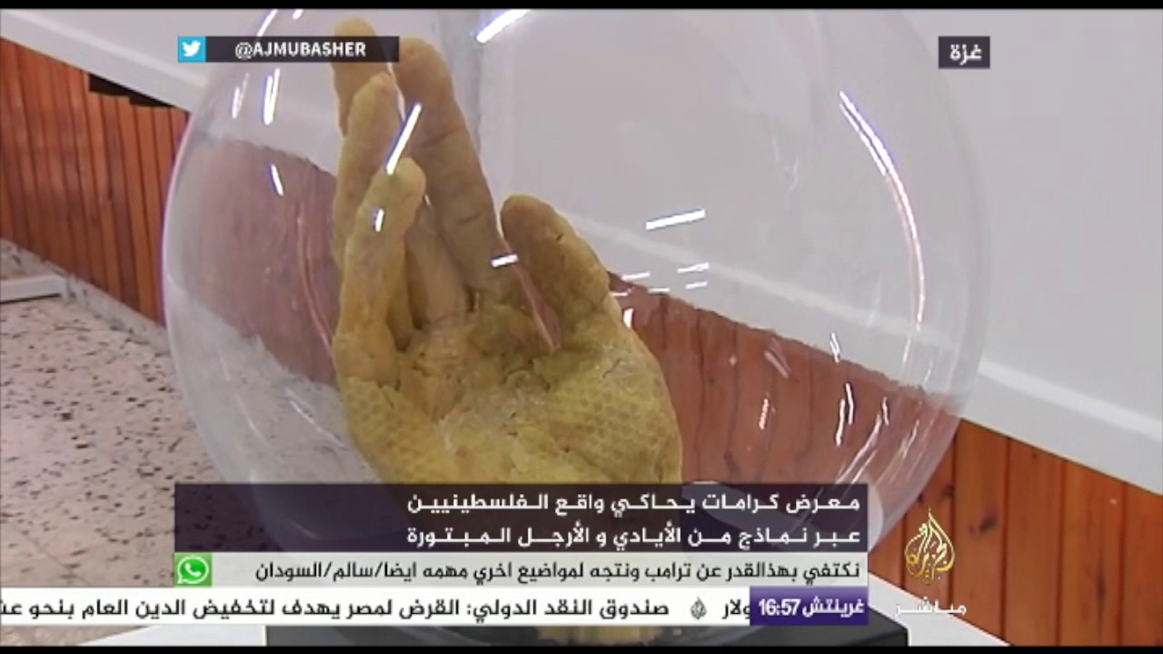 معرض في غزة لمناذج أيادي وأرجل مبتورة يحكي واقع الفلسطينيين