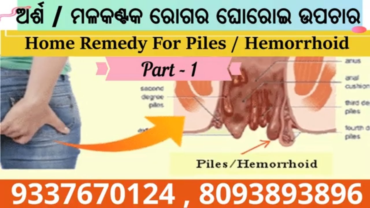 Piles Home Remedy In Odia Piles Treatment ଅର୍ଶ ମଳକଣ୍ଟକ ରୋଗର ଉପଚାର