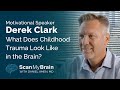 What Does Childhood Trauma Look Like in the Brain? / Scan My Brain x Derek Clark