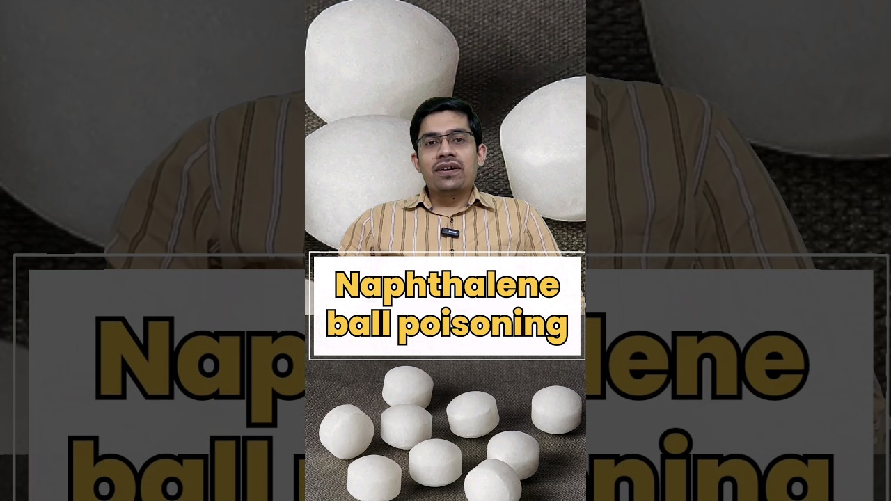 Accidental poisoning with Naphthalene balls in children's. अनजाने में बच्चे ने खा लिया naphthalene