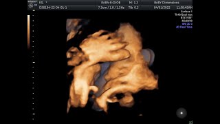 IMG 20220401 1 7 VolCine