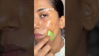 How I treated this?  Remedy which Calms + Kills Bacteria #shorts