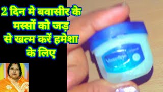 2 दिन मे बवासीर के मस्सों को खत्म करें हमेशा के लिए/Piles treatment/Bavasir ka gharelu ilaj