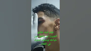 علاج الجروح بدون اثر للجروح من غير خياطه 