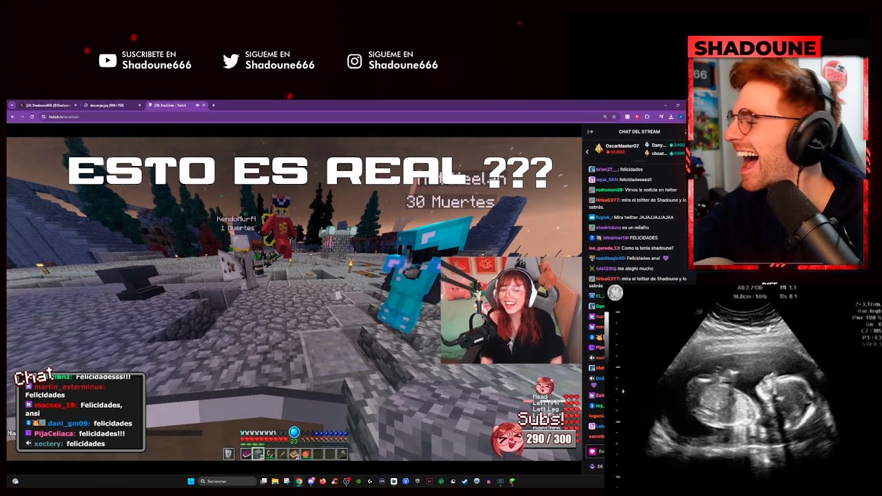 ansi y shadoune tendran un hijo ?