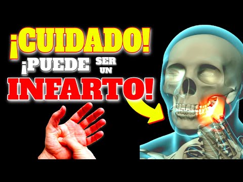 Video: 3 formas de reducir las posibilidades de un ataque cardíaco