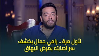 النجم رامي جمال يكشف سر لأول مرة عن سبب اصابته بمرض البهاق: كنت نايم زعلان!💔