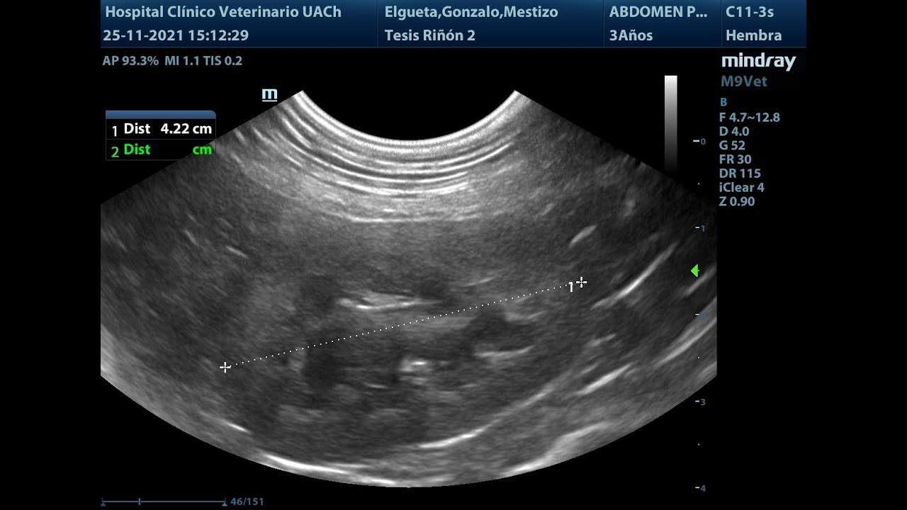 Medición de riñón canino utilizando el índice Riñón-Aorta - YouTube