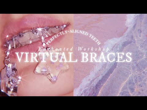 ☾. VIRTUAL BRACES˚✩