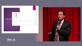 PoTS Masterclass 2017 - Dr Nick Gall