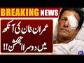 Imran Khan Health Update | Doctors Gives Second Eye Injection | Shocking News For PTI | Dunya News