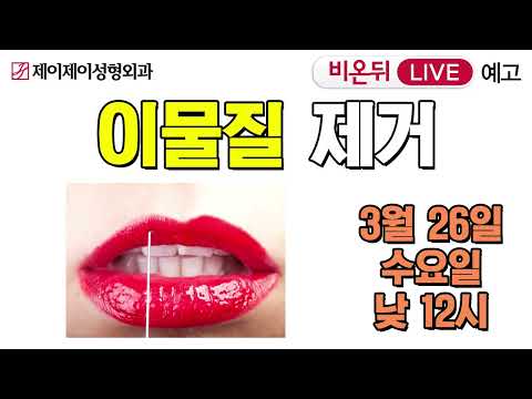 비온뒤 예고) 이물질 제거 - 유튜브 의학채널 비온뒤 (<strong>제이제이성형외과</strong>)