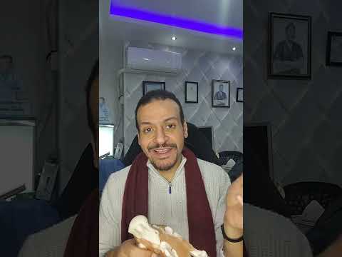الشوكة العظمية د محمد الشاعر اكسبلور عظام التهاب