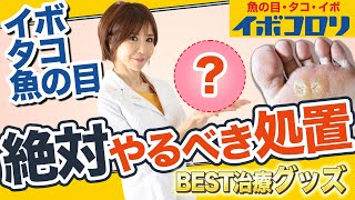 【イボ・タコ・魚の目】今スグ実践！最短治療のコツは削ること！皮膚科医がイボコロリを使って実演します