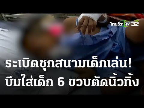 ตร.เร่งหาเจ้าของกระเป๋าซุกระเบิด บึมใส่เด็ก 6 ขวบเจ็บ | 24 ก.ย. 66 | ไทยรัฐทันข่าว