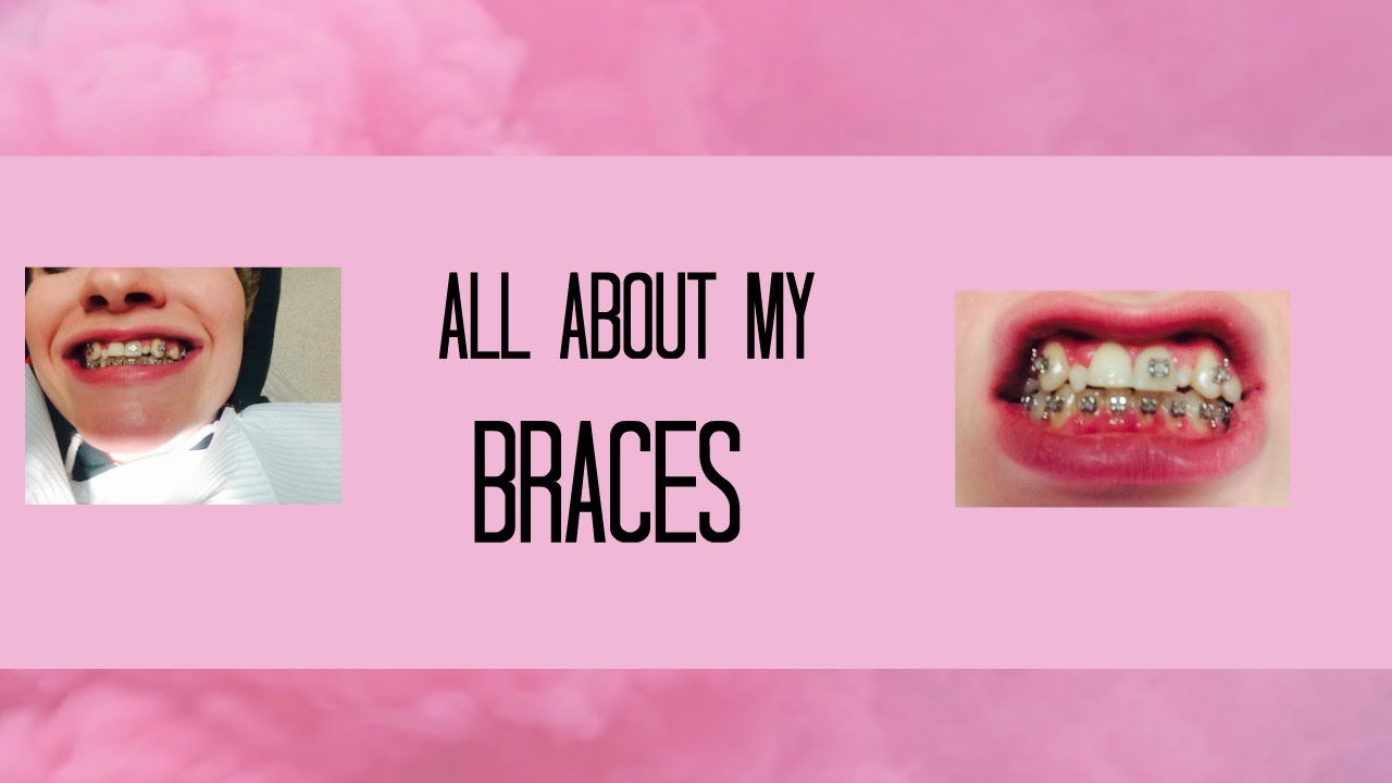 All About My Braces YouTube