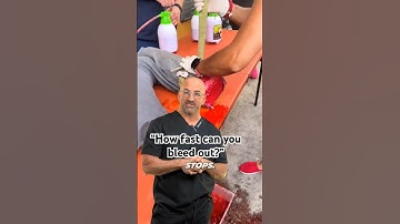 Femoral Artery Injury - How Much Time Do You Have? #shorts