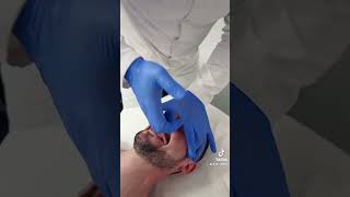 Rhinoseptoplasty, Septoplasty Without Surgery