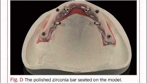 Bench Mastery: Aesthetic Press Ceramic 2.0