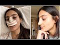 Dealing with Post Surgery Depression & Reading my Hate Comments