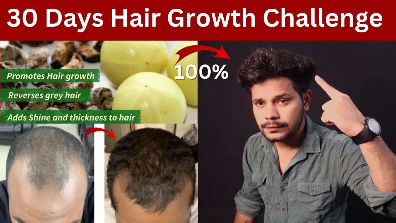 30 Days Hairfall Stop Challenge || Grow Hair Faster, Longer & Thicker ...